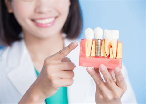 affordable care dental implants
